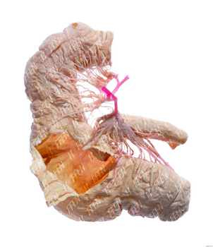 猪盲肠塑化标本